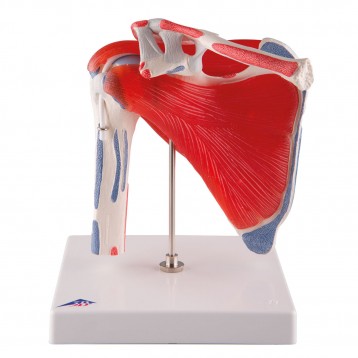 Epaule avec Coiffe des Rotateurs - 5 pièces